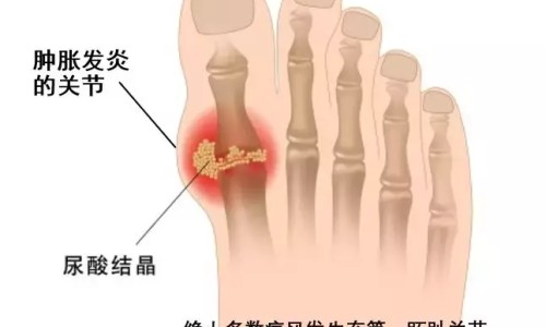 纤盈力是正规品牌吗-【纤盈力是正规品牌吗】纤盈力是正规品牌吗 - 纤盈御露功效网